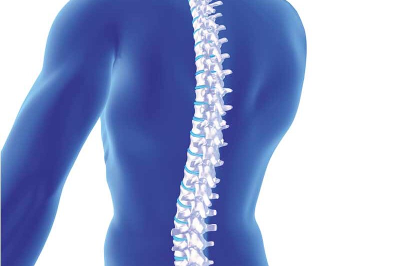 Spinal Orthoses