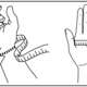 VISSION™ Wrist Orthosis Dorsal 